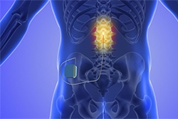 Beyond Medication: Exploring Innovative Pain Management Techniques