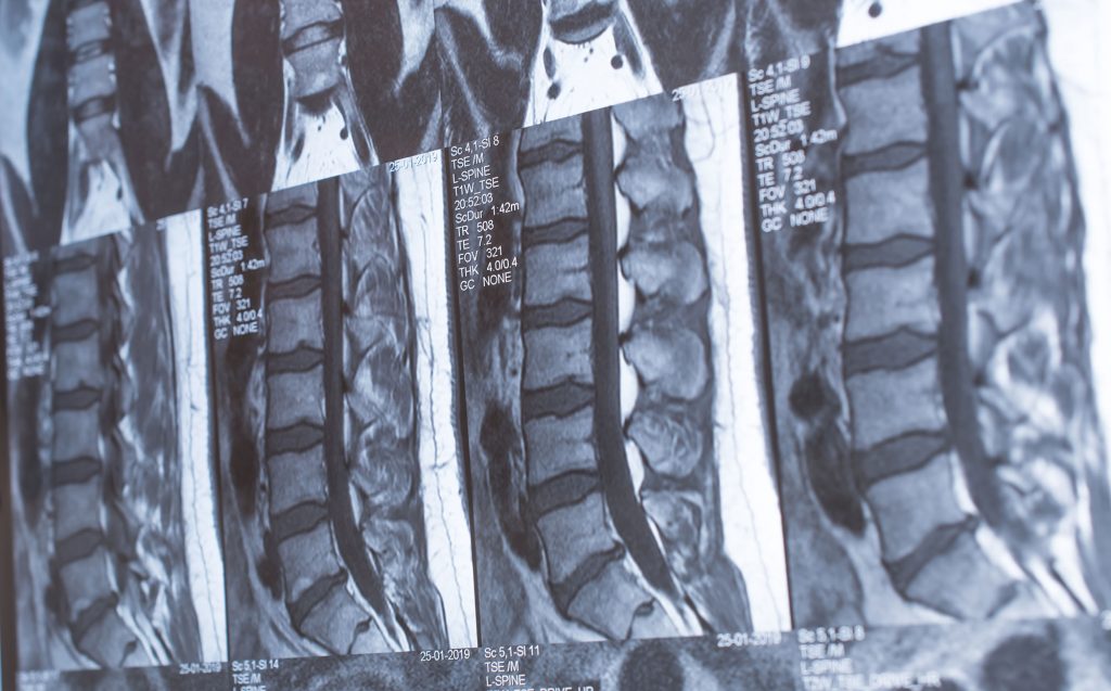 Img-Conditions that Commonly Cause Chronic Pain